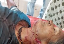 पारगाव येथे बिबट्याने पुन्हा केला महीलेवर हल्ला