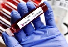 बापरे! चक्क कोरोना निगेटिव्ह रीपोर्ट दिला पॉझिटिव्ह