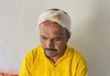 लग्नात सत्काराला नाव पुकारले नाही, तलाठ्याने घातला तरुणाच्या डोक्यात लोखंडी माईक, तरुण जखमी
