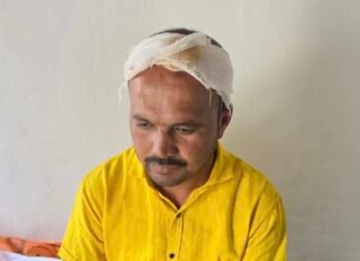 लग्नात सत्काराला नाव पुकारले नाही, तलाठ्याने घातला तरुणाच्या डोक्यात लोखंडी माईक, तरुण जखमी